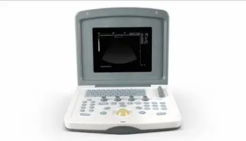 Orvosi Ultrahang Berendezés SINOHERO S880 Kézi Magas Minőségű Kép Kórház, Klinika Használja Hordozható Utrasound Szkenner Gép
